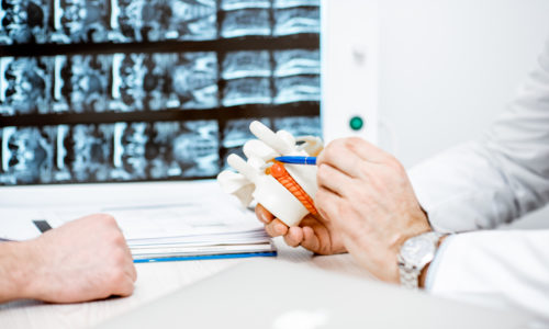 What Are Your Options for Hernia Repair?