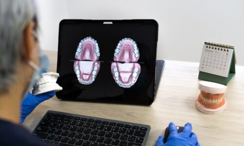 How to Upgrade Dental Equipment for Better Patient Care